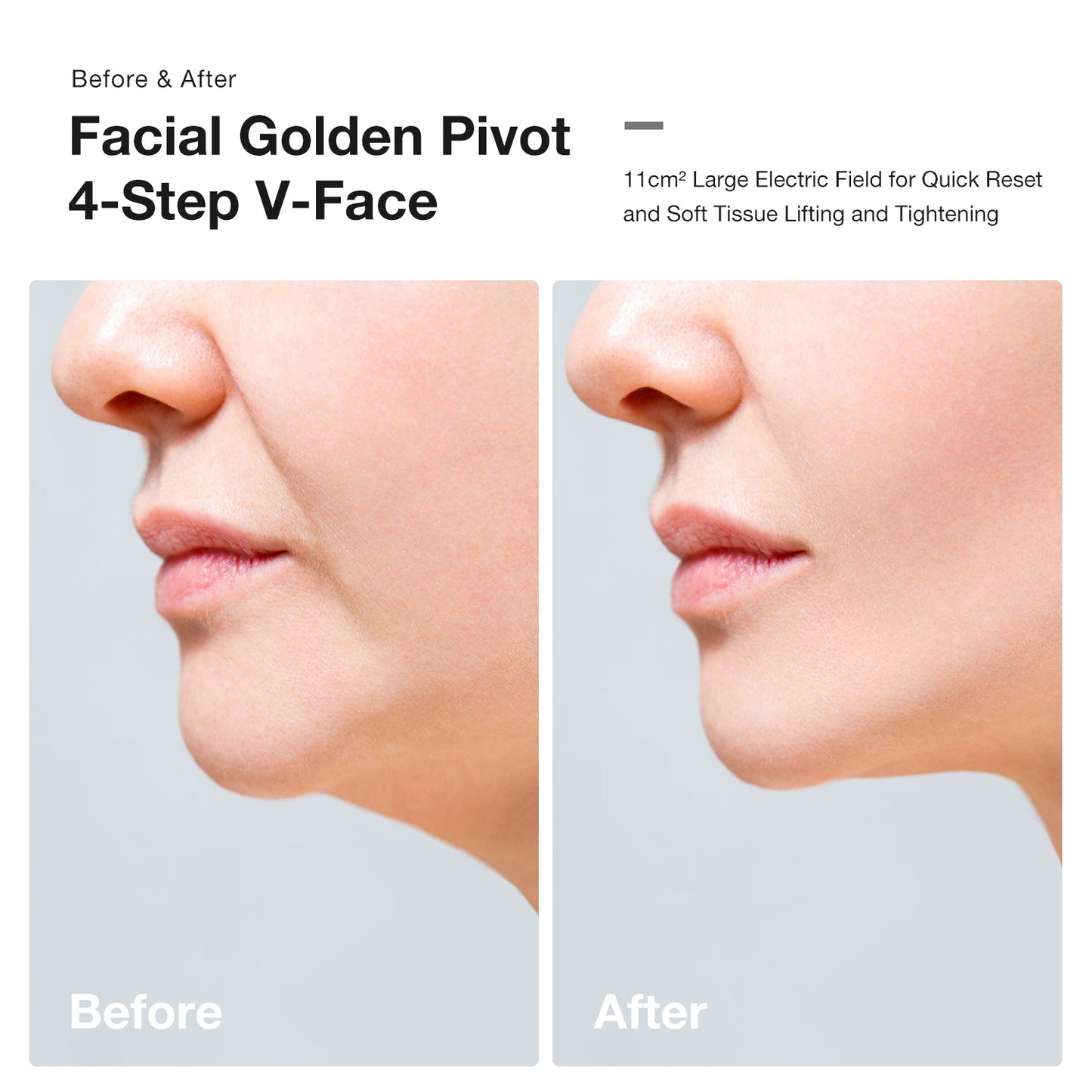 JOVS Slimax Microcurrent & Laser Light Anti-aging Device