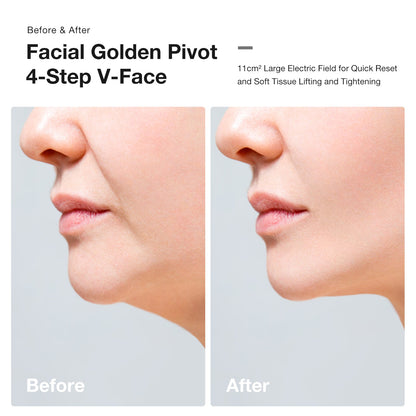 JOVS Slimax Microcurrent & Laser Light Anti-aging Device